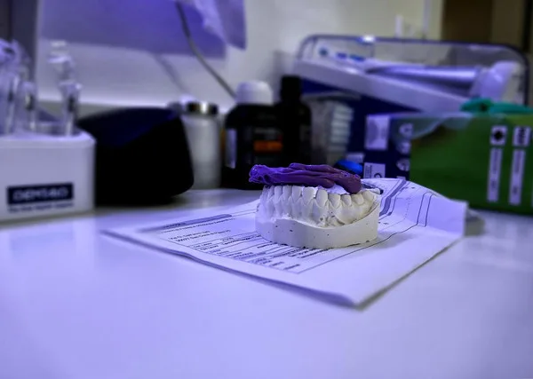 Objawy stanu zapalnego po wszczepieniu implantu zęba